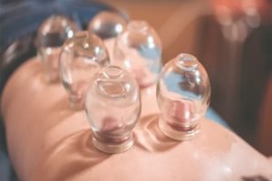 مساج الحجامة